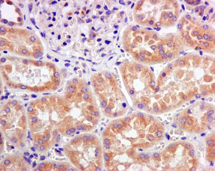 Immunohistochemistry (Formalin/PFA-fixed paraffin-embedded sections) - Anti-DCTN4 antibody [EPR11223] (AB170107), expandable thumbnail
