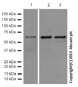 Western blot - Anti-DCTN4 antibody [EPR11223] (AB170107), expandable thumbnail