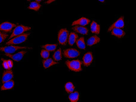 Immunocytochemistry/ Immunofluorescence - Anti-DCTN4 antibody [EPR11223] - BSA and Azide free (AB249534)