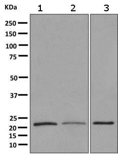 Western blot - Anti-DCTN5 antibody [EPR11253] (AB157197)