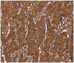 Immunohistochemistry (Formalin/PFA-fixed paraffin-embedded sections) - Anti-DCTN6/WS3 antibody (AB197913)