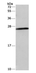 Western blot - Anti-DCTN6/WS3 antibody (AB197913)