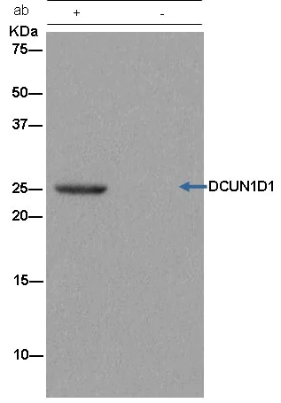 Immunoprecipitation - Anti-DCUN1D1 antibody [EPR13492] - BSA and Azide free (AB250448)
