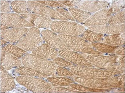 Immunohistochemistry (Formalin/PFA-fixed paraffin-embedded sections) - Anti-DCUN1D4 antibody (AB154095)