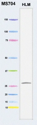 Western blot - Anti-DCXR antibody [4G4AF5] (AB110283)