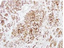 Immunohistochemistry (Formalin/PFA-fixed paraffin-embedded sections) - Anti-DCXR antibody (AB154290)