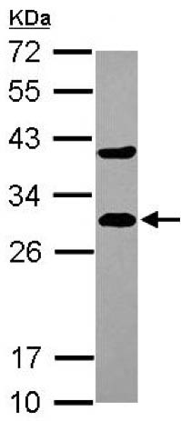 Western blot - Anti-DCXR antibody (AB154290), expandable thumbnail