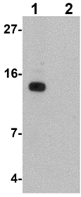Western blot - Anti-DDA1 antibody (AB117440)