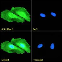 Immunocytochemistry - Anti-DDAH1 antibody (AB2231)