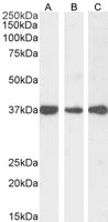 Western blot - Anti-DDAH1 antibody (AB2231)