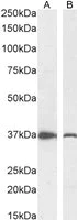 Western blot - Anti-DDAH1 antibody (AB2231)