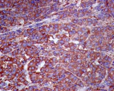 Immunohistochemistry (Formalin/PFA-fixed paraffin-embedded sections) - Anti-DDAH1 antibody [EPR13921] (AB181859)