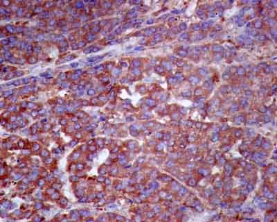 Immunohistochemistry (Formalin/PFA-fixed paraffin-embedded sections) - Anti-DDAH1 antibody [EPR13921] (AB181859)