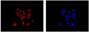 Immunocytochemistry/ Immunofluorescence - Anti-DDAH1 antibody [EPR13922] (AB180599), expandable thumbnail
