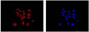 Immunocytochemistry/ Immunofluorescence - Anti-DDAH1 antibody [EPR13922] - BSA and Azide free (AB240228)