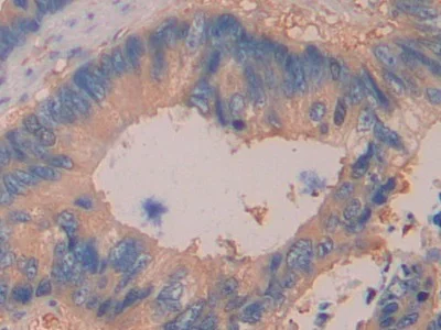 Immunohistochemistry (Formalin/PFA-fixed paraffin-embedded sections) - Anti-DDAH2 antibody (AB232694)