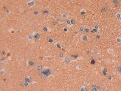 Immunohistochemistry (Formalin/PFA-fixed paraffin-embedded sections) - Anti-DDAH2 antibody (AB232694)