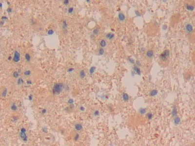 Immunohistochemistry (Formalin/PFA-fixed paraffin-embedded sections) - Anti-DDAH2 antibody (AB232694)