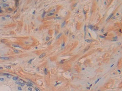 Immunohistochemistry (Formalin/PFA-fixed paraffin-embedded sections) - Anti-DDAH2 antibody (AB232694)