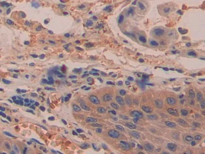 Immunohistochemistry (Formalin/PFA-fixed paraffin-embedded sections) - Anti-DDAH2 antibody (AB232694)