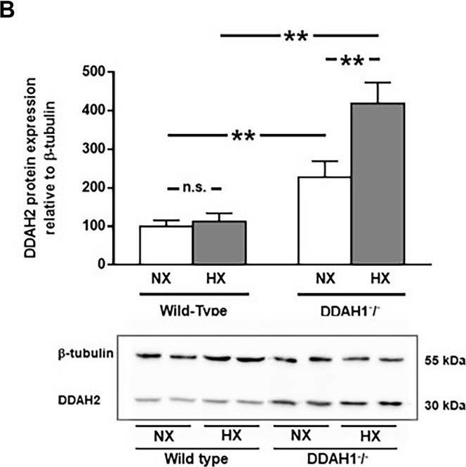 Western blot - Anti-DDAH2 antibody [EPR15508(B)] (AB184166)