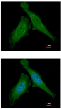 Immunocytochemistry/ Immunofluorescence - Anti-DDB1 antibody (AB97522), expandable thumbnail
