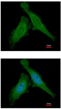 Immunocytochemistry/ Immunofluorescence - Anti-DDB1 antibody (AB97522)