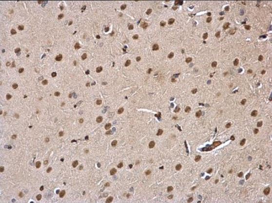 Immunohistochemistry (Formalin/PFA-fixed paraffin-embedded sections) - Anti-DDB1 antibody (ab97522), expandable thumbnail