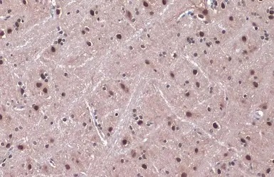 Immunohistochemistry (Formalin/PFA-fixed paraffin-embedded sections) - Anti-DDB1 antibody (AB97522)
