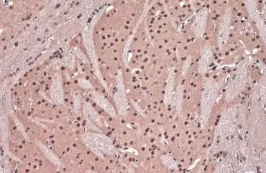 Immunohistochemistry (Formalin/PFA-fixed paraffin-embedded sections) - Anti-DDB1 antibody (AB97522)