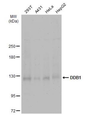 Western blot - Anti-DDB1 antibody (ab97522), expandable thumbnail