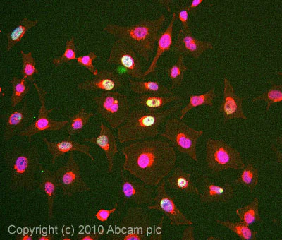 Immunocytochemistry/ Immunofluorescence - Anti-DDB2 antibody [2246C4a] (AB51017)