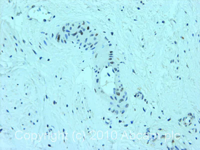 Immunohistochemistry (Formalin/PFA-fixed paraffin-embedded sections) - Anti-DDB2 antibody [2246C4a] (AB51017)