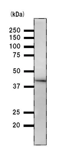 Western blot - Anti-DDB2 antibody [2246C4a] (AB51017)