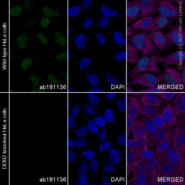 Immunocytochemistry/ Immunofluorescence - Anti-DDB2 antibody [EPR9811] (AB181136)