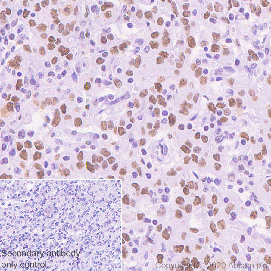 Immunohistochemistry (Formalin/PFA-fixed paraffin-embedded sections) - Anti-DDB2 antibody [EPR9811] (AB181136)