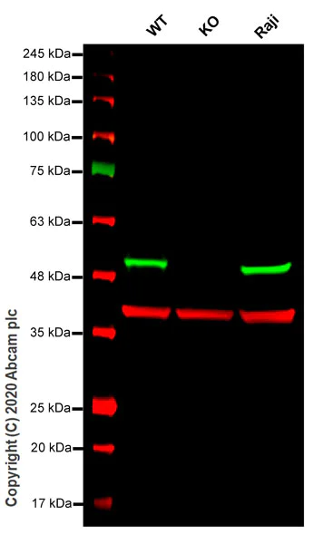 Western blot - Anti-DDB2 antibody [EPR9811] (AB181136)