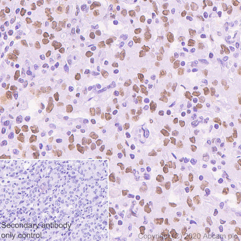 Immunohistochemistry (Formalin/PFA-fixed paraffin-embedded sections) - Anti-DDB2 antibody [EPR9811] - BSA and Azide free (AB250373)