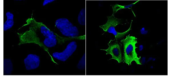 Immunocytochemistry - Anti-DDDDK tag (Binds to FLAG® tag sequence) antibody (AB1162)