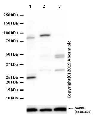 Western blot - Anti-DDDDK tag (Binds to FLAG® tag sequence) antibody [EPR20018-251] (AB205606)