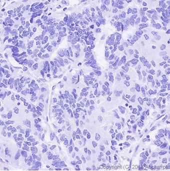 Immunohistochemistry (Formalin/PFA-fixed paraffin-embedded sections) - Anti-DDDDK tag (Binds to FLAG® tag sequence) antibody [EPR20018-251] - BSA and Azide free (ab236777), expandable thumbnail
