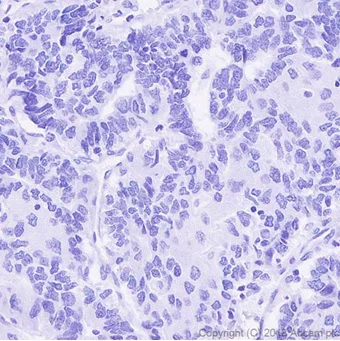 Immunohistochemistry (Formalin/PFA-fixed paraffin-embedded sections) - Anti-DDDDK tag (Binds to FLAG® tag sequence) antibody [EPR20018-251] - BSA and Azide free (AB236777)