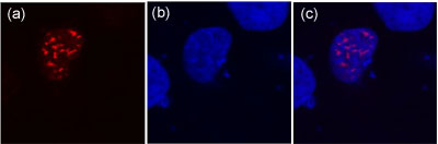 Immunocytochemistry - Anti-DDDDK tag (Binds to FLAG® tag sequence) antibody [F-tag-01] (AB18230), expandable thumbnail
