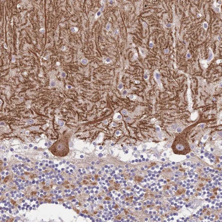 Immunohistochemistry (Formalin/PFA-fixed paraffin-embedded sections) - Anti-DDHD1 antibody (AB151078)
