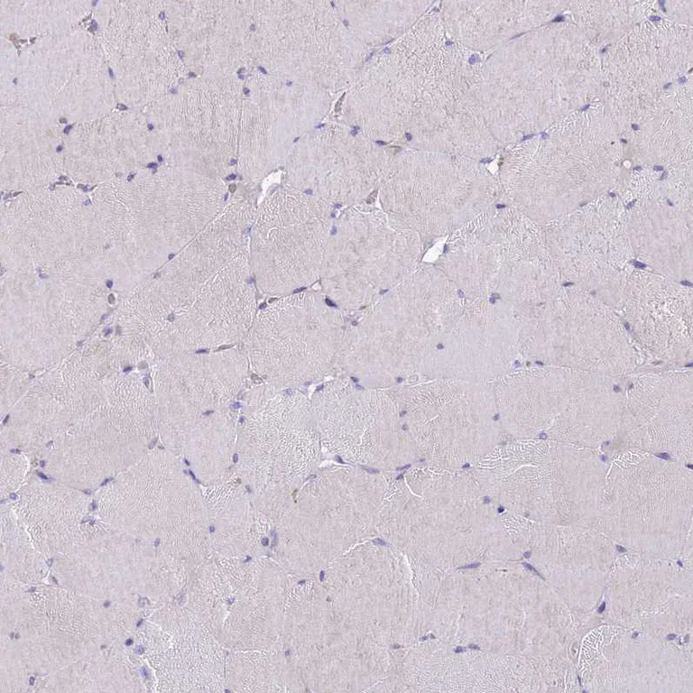 Immunohistochemistry (Formalin/PFA-fixed paraffin-embedded sections) - Anti-DDHD1 antibody (AB151078)