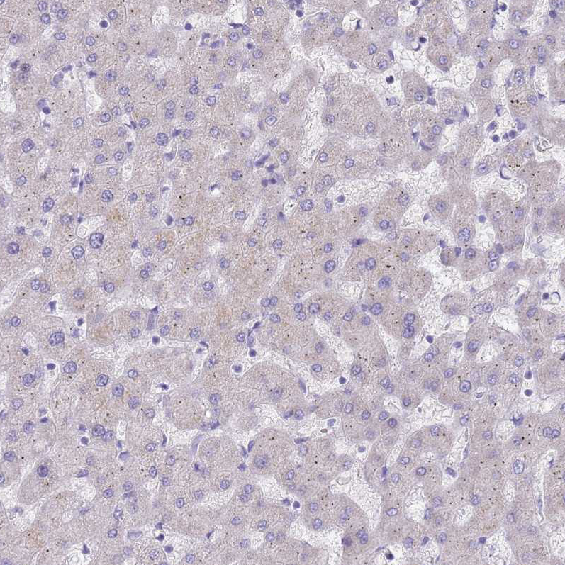 Immunohistochemistry (Formalin/PFA-fixed paraffin-embedded sections) - Anti-DDHD1 antibody (AB151078)