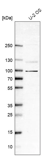Western blot - Anti-DDHD1 antibody (AB151078)
