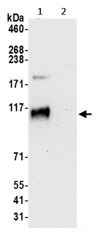 Immunoprecipitation - Anti-DDHD1 antibody (AB241975)