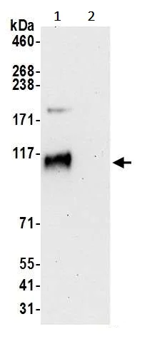 Immunoprecipitation - Anti-DDHD1 antibody (AB241975)
