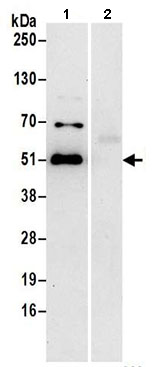 Immunoprecipitation - Anti-DDI2 antibody (AB197081)
